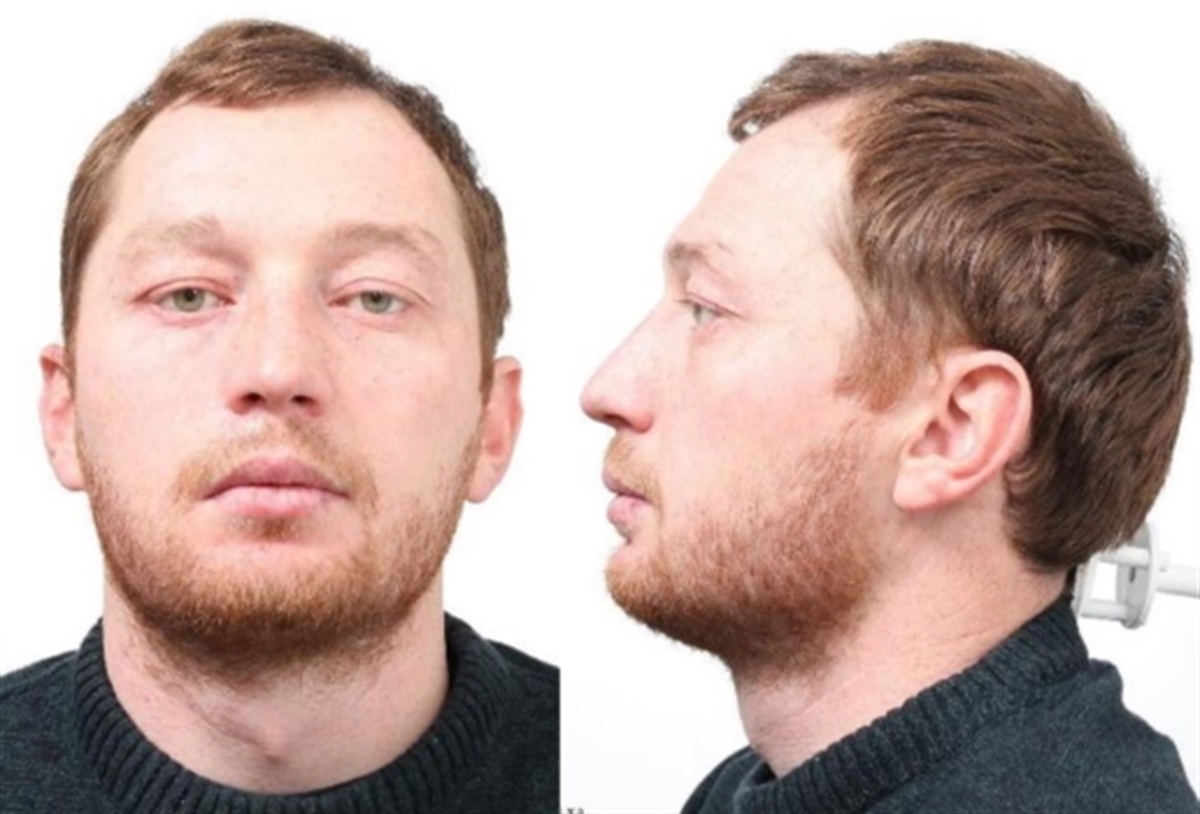 Ein frontales und ein seitliches Fahndungsfoto des gesuchten Mannes.